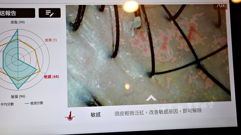 1825頭皮養護中心頭皮跟臉一樣都需要好好呵護,東門捷運站 1825頭皮養護中心頭皮跟臉一樣都需要好好呵護,東門捷運站