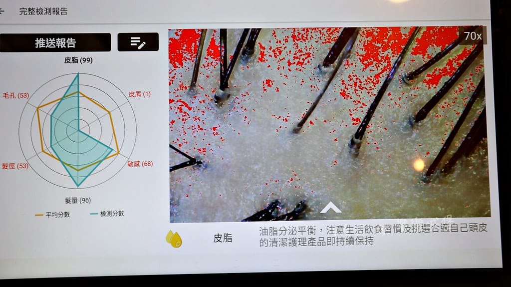 1825頭皮養護中心頭皮跟臉一樣都需要好好呵護,東門捷運站 1825頭皮養護中心頭皮跟臉一樣都需要好好呵護,東門捷運站