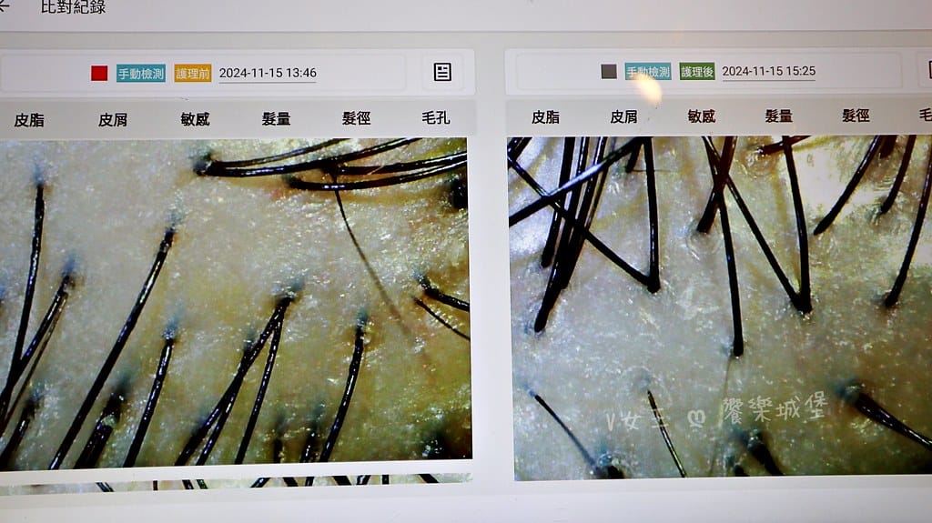 1825頭皮養護中心頭皮跟臉一樣都需要好好呵護,東門捷運站 1825頭皮養護中心頭皮跟臉一樣都需要好好呵護,東門捷運站