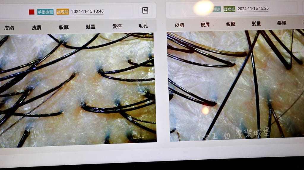 1825頭皮養護中心頭皮跟臉一樣都需要好好呵護,東門捷運站 1825頭皮養護中心頭皮跟臉一樣都需要好好呵護,東門捷運站