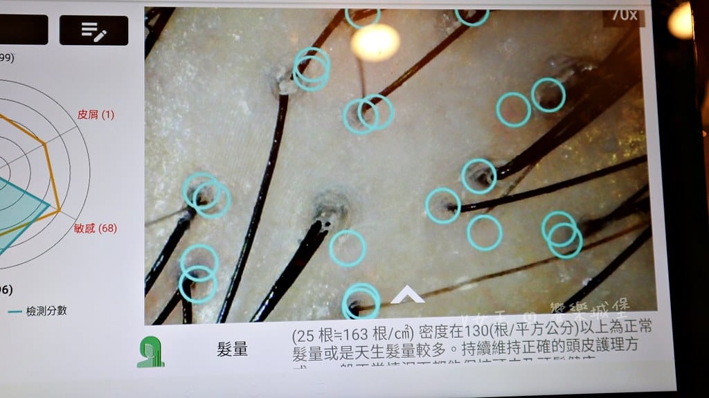 1825頭皮養護中心頭皮跟臉一樣都需要好好呵護,東門捷運站 1825頭皮養護中心頭皮跟臉一樣都需要好好呵護,東門捷運站