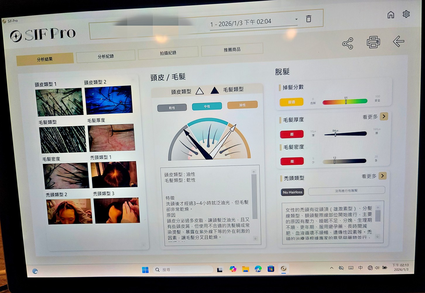 1825頭皮養護中心 ll 東門捷運站,植萃雙效奇肌修護 重拾健康頭皮,頭皮跟臉一樣都需要好好照顧喔! - 第11張圖 1825頭皮養護中心 ll 東門捷運站,植萃雙效奇肌修護 重拾健康頭皮,頭皮跟臉一樣都需要好好照顧喔!