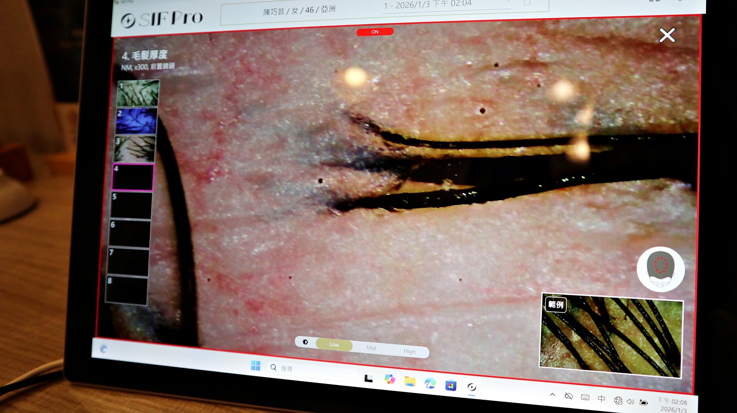 1825頭皮養護中心 ll 東門捷運站,植萃雙效奇肌修護 重拾健康頭皮,頭皮跟臉一樣都需要好好照顧喔! - 第10張圖 1825頭皮養護中心 ll 東門捷運站,植萃雙效奇肌修護 重拾健康頭皮,頭皮跟臉一樣都需要好好照顧喔!