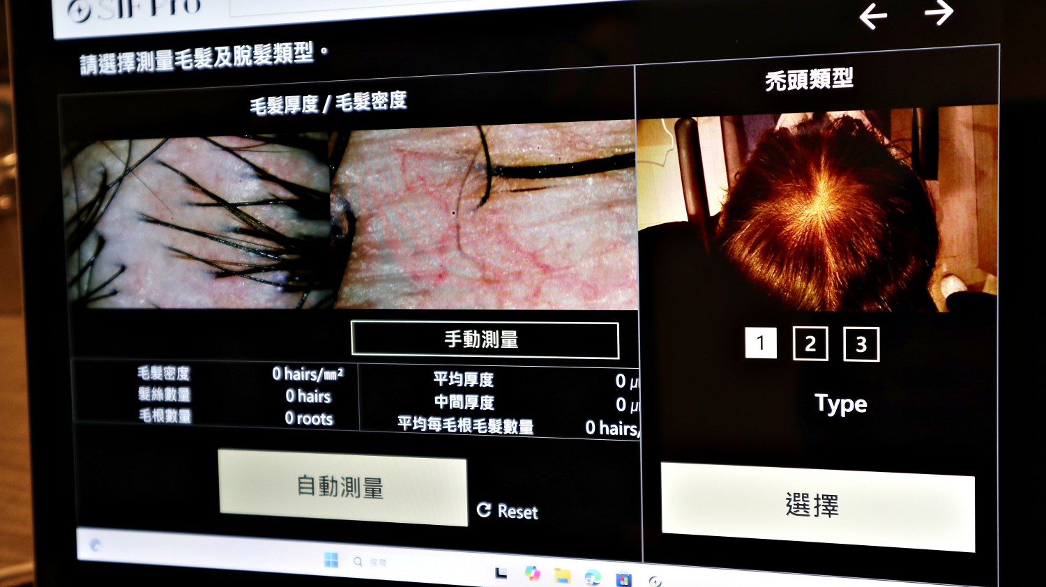 1825頭皮養護中心 ll 東門捷運站,植萃雙效奇肌修護 重拾健康頭皮,頭皮跟臉一樣都需要好好照顧喔! - 第9張圖 1825頭皮養護中心 ll 東門捷運站,植萃雙效奇肌修護 重拾健康頭皮,頭皮跟臉一樣都需要好好照顧喔!